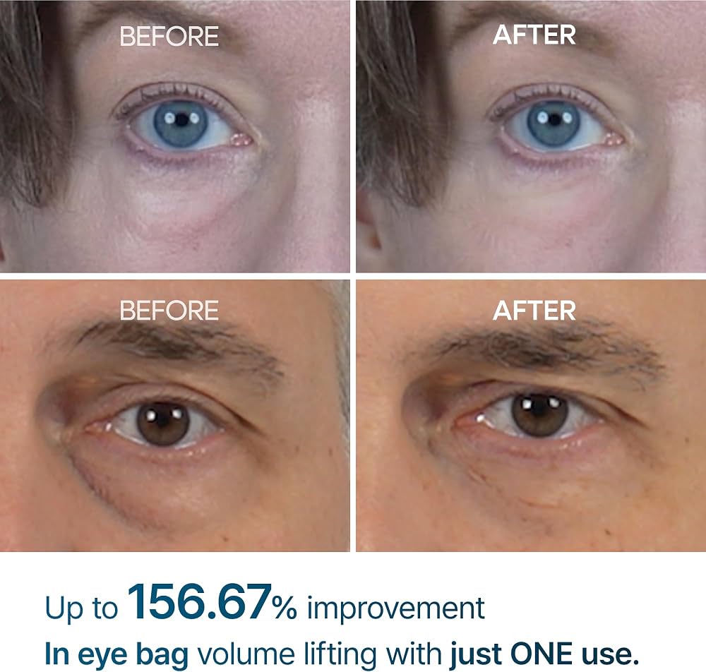 Dr. Melaxin Eyephalt Eye Cream pour poches, cernes et ridules
