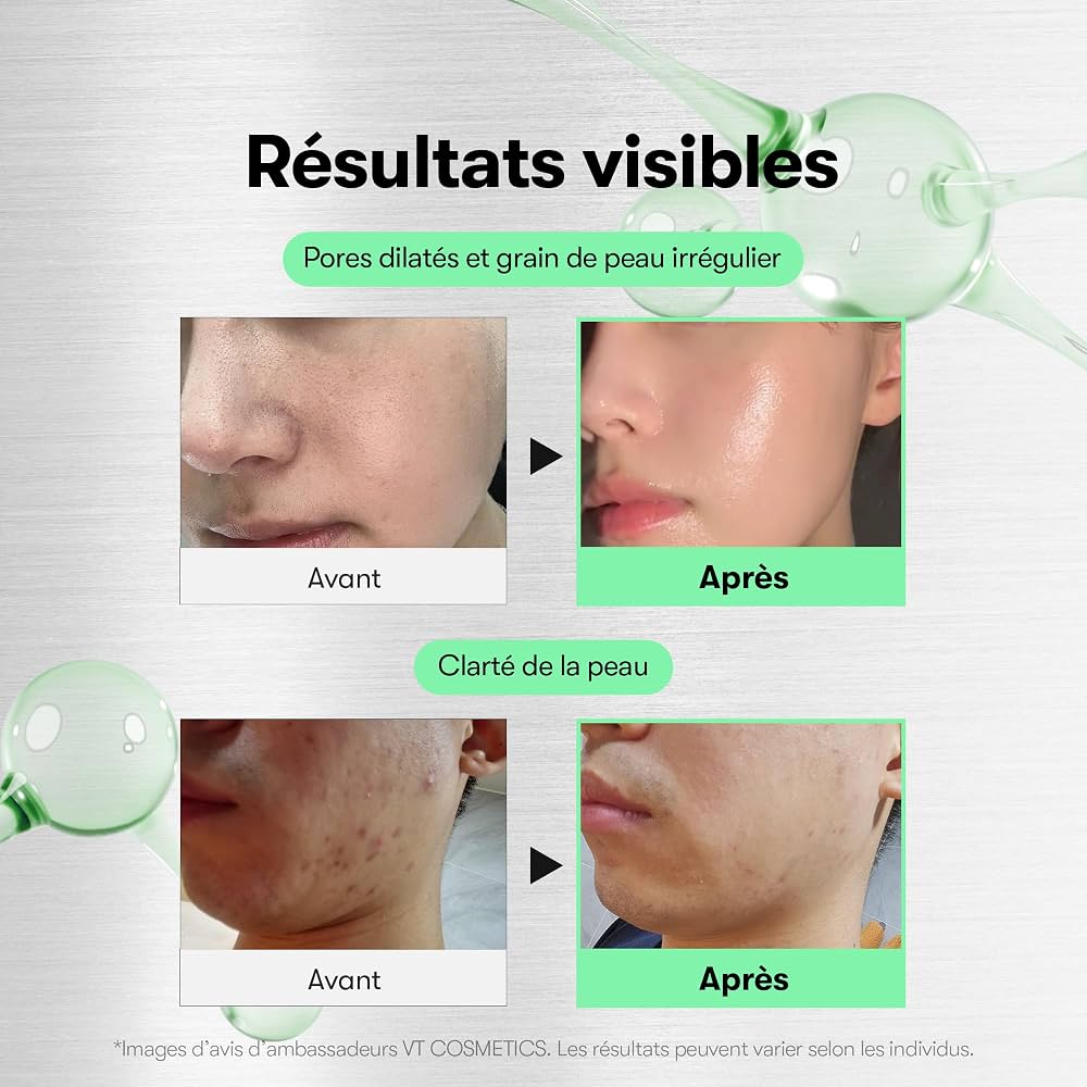 VT Cosmetics Reedle Shot 100 au Centella Asiatica et acide hyaluronique