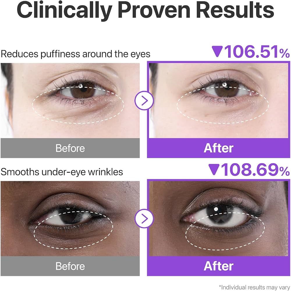 Numbuzin No.9 NAD+ Collagen Under Eye Patches – 5 paires