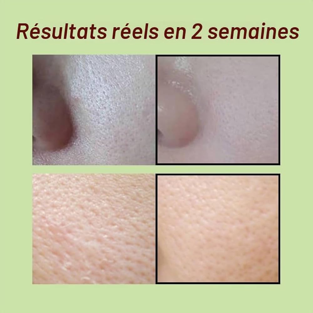SUNGBOON EDITOR Green Tomato Pore Lifting Ampoule+ – Ampoule pores & fermeté 75 ml